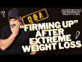 How Did Ethan Tighten Up His Skin After Losing Weight