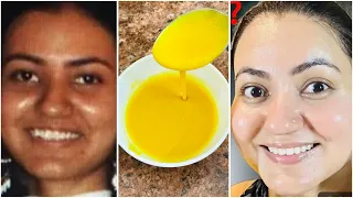 Collagen Wajiga Cadeynayo Qurxinayo Bbe Face Na Ka Dhigayo Hubal  Collagen Wajiga Cadeynayo Qurxinayo Bbe Face Na Ka Dhigayo Hubal