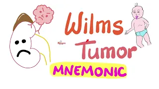 Wilms Tumor (Nephroblastoma) -  Mnemonic - Renal Pathology - Nephrology Playlist - Pediatrics