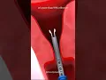 Download Lagu Mirena IUD for Endometriosis | Mirena IUD Experience #familyplanning #contraception #miren