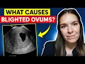 What causes blighted ovum anembryonic pregnancy
