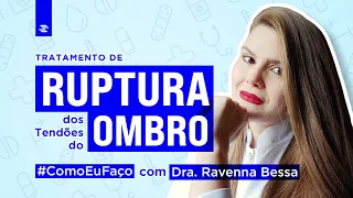 Como Eu Faço: Tratamento de Ruptura do Tendão do Ombro com Dra. Ravenna Bessa