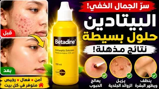ازاي معندكيش بيتادين لحد دلوقتي 😱         استخدمات اول مره تعرفيها والأخيرة هتصدمك