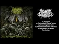 Download Lagu 𝐀𝐩𝐨𝐩𝐭𝐨𝐬𝐢𝐬 𝐆𝐮𝐭𝐫𝐞𝐜𝐭𝐨𝐦𝐲 - 𝐃𝐞𝐥𝐮𝐬𝐢𝐨𝐧 𝐈𝐧𝐭𝐞𝐫𝐦𝐢𝐧𝐮𝐬 𝐕𝐢𝐭𝐚𝐞 (𝐄𝐏) 𝟐𝟎𝟏𝟓