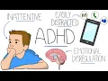 Understanding Attention Deficit Hyperactivity Disorder AD