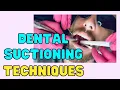 DENTAL SUCTIONING TECHNIQUES Tips For Dental Assistants