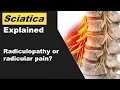 Radicular Pain vs Radiculopathy vs Sciatica Nerve Root Pain Explained for Physios