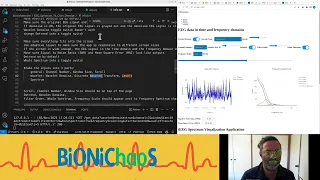 Enhancing EEG Data Visualization Web App Development Journey