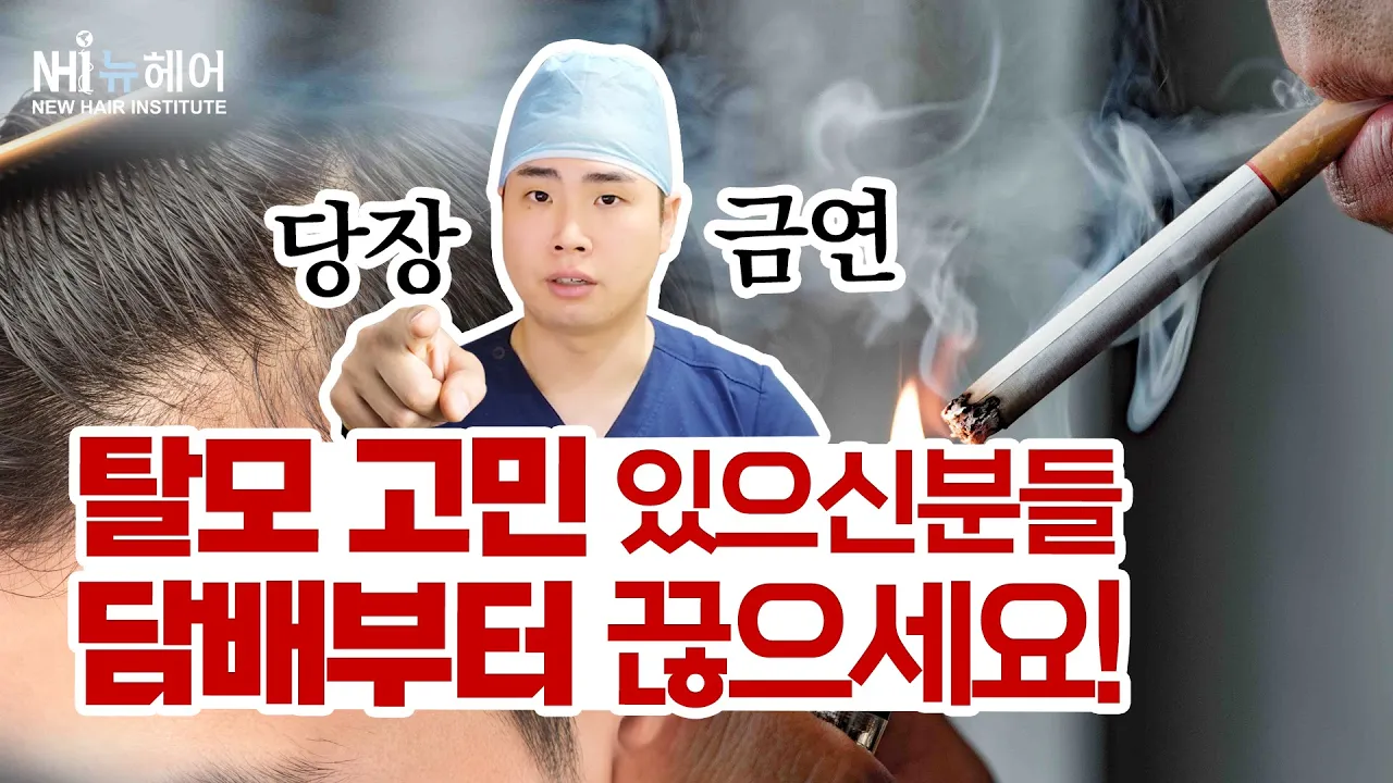 흡연자 주목! 담배 피우면 탈모 심해진답니다 l 뉴헤어