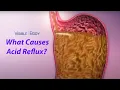 Visible Body What Causes Acid Reflux