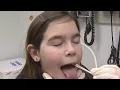 What are the signs and symptoms of strep throat