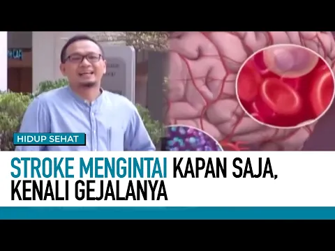 Kenali Gejala Stroke Sejak Dini