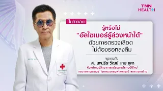 การตรวจหาความเสี่ยงของอัลไซเมอร์สามารถทำได้อย่างไร