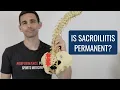 Is Sacroiliitis Permanent