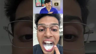 Comprimido que tira Cárie e deixa dentes brancos