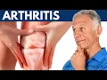 What I Wish Everyone Would Know About Arthritis