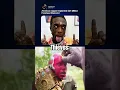 Download Lagu Jonge, zwarte en rijke Amerikaanse rapper heeft een voorhoofdspierimplantaat van 24 miljoen Dimond gekregen