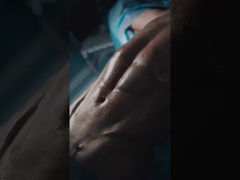CANSADO DE TREINAR E NÃO VER O SIX-PACK? 🔥 Veja este resultado de Lipo HD Masculina!