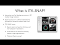 RSNA 2016 ITK-SNAP Training - Intro Manual Segmentation