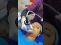 Korean Glass Facial Treatment in Jaipur Radiant Skin and ENT Clinic
