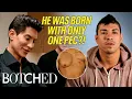 Justin Jedlica Returns to Create An Implant for Albert s Missing Pec Before After Botched E