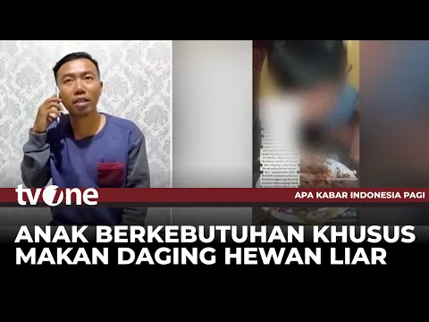 Viral di Medsos Anak Berkebutuhan Khusus Jadi Korban Perundungan