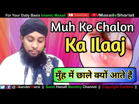 Munh Ke Chalon Ka Ilaj | Munh Me Bar Bar Chale Kyun Aate Hain | Sikander Warsi about Chalo ka Ilaj