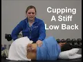 Advanced Cupping Techniques Myofascial Decompression for a Stiff Low back LBP