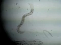 100x Adult Hermaphrodite Moving