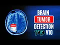 Brain Tumor Detection Classification using YOLOv10 Computer Vision Custom YOLO Model