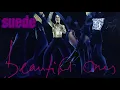 Suede - Beautiful Ones (Audio Only)