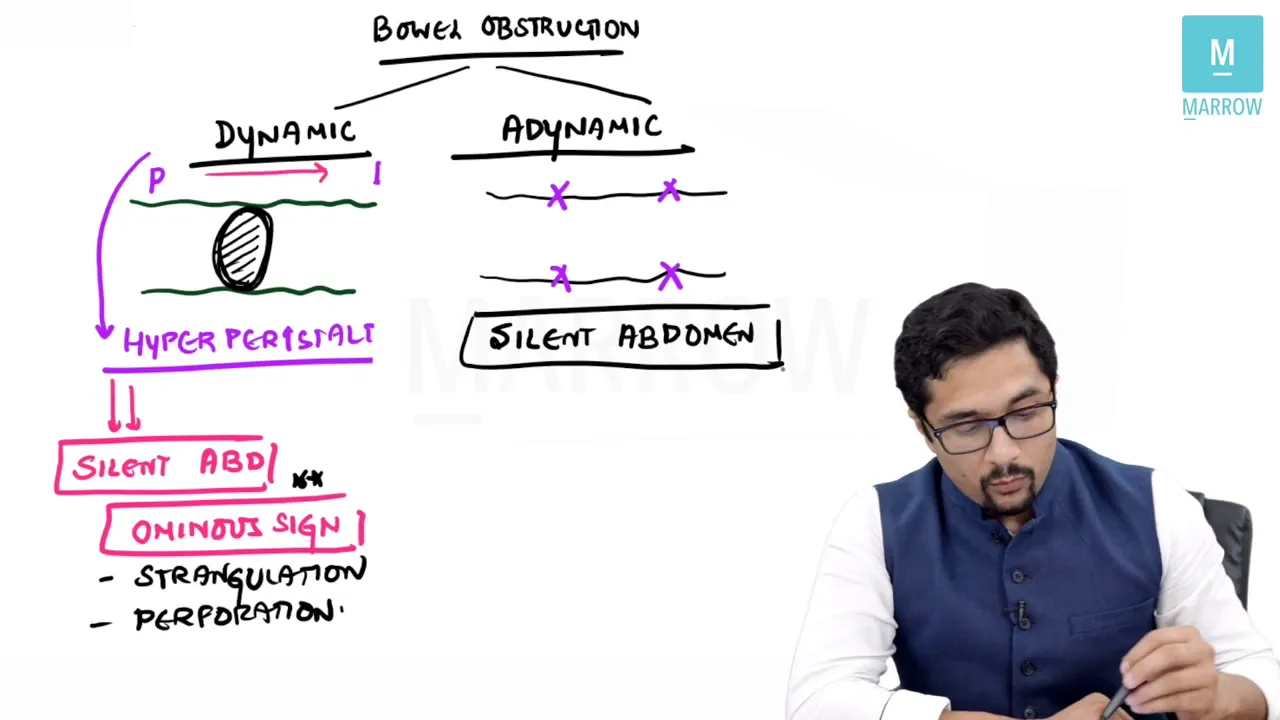 Basics of Bowel Obstruction for MBBS/ NEET PG/ AIIMS/ PGI/ JIPMER exams