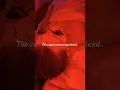 facial acupuncture by soulmei in nyc