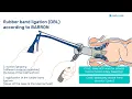 Hemorrhoidal Disease Surgery Explained Full Lecture Hemorrhoidectomy