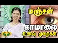 Download Lagu மஞ்சகாமாலை உணவு முறை என்ன ? | Jaundice | Nutrition Diary | Adupangarai | Jaya TV
