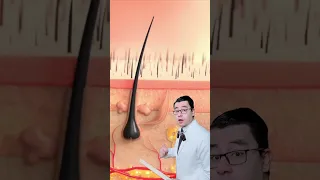 ازالة الشعر بالشمع 