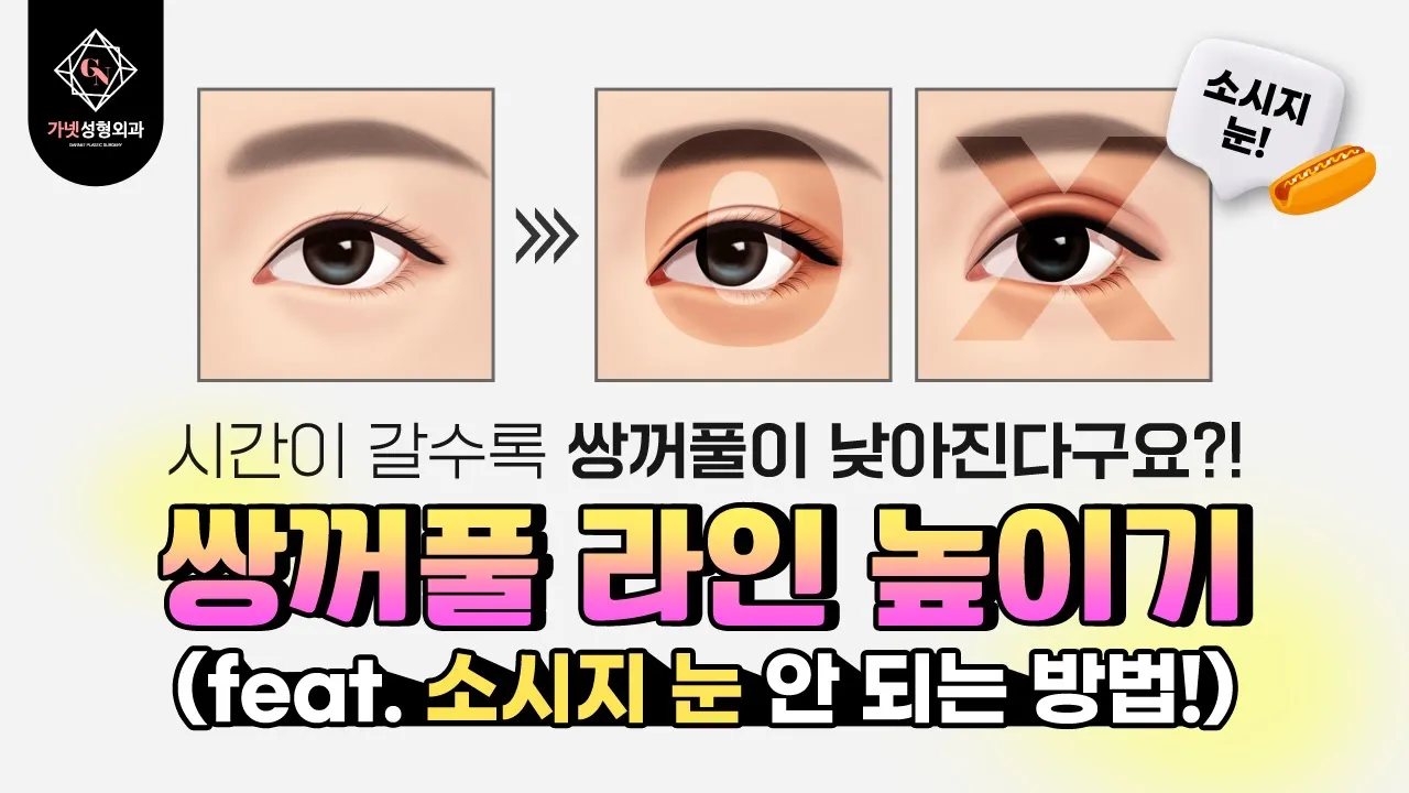 쌍꺼풀 라인 높이기가 뭐야?🤷‍♀️ │ 쌍수재수술 시 고려할 사항은?│🌭소세지눈 되기 싫다면 꼭 보세요!