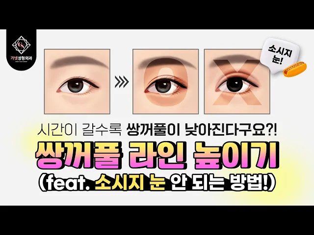 쌍꺼풀 라인 높이기가 뭐야?🤷‍♀️ │ 쌍수재수술 시 고려할 사항은?│🌭소세지눈 되기 싫다면 꼭 보세요!