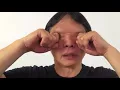 Daily exercise get rid of eye strain and improve vision naturally
