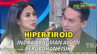 Download Hadapi Penyakit Hipertiroid, Indra Brugman Alami Perubahan Fisik | RUMPI (28/10/22) P1 MP3