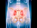 How To Balance Hips in 3 min Massage therapy Life Rx Los Angeles