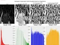 Local Global Histogram Equalization Algorithms AHE CLAHE python