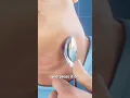 How Vacuum Hoses Cause Hickeys