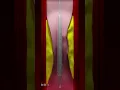 Download Lagu Coronary Artery Stent Placement (Animation)