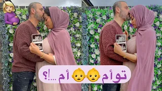 حامل للمرة الرابعة🤰🏼🤭شنو بان فالإيكو توأم أم …‼️ردة فعل راجلي بكّاتني 🥺