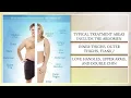 DOLCE AESTHETICS special offer CoolSculpting Scottsdale Arizona