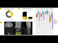S073 Classification of Ovarian Neoplasms with 3D Supervised Contrastive-Learning Approach