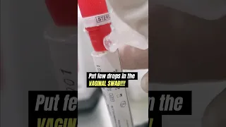 Vaginal Yeast Infection Under The Microscope Laboratory Microscope Mls Cls Fungalhyphae Fungi 