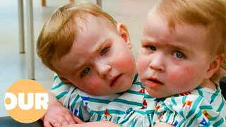 Katie and Eilish The Unbreakable Bond of Conjoined Twins Our Life