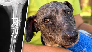 A Shotgun Destroyed His Elbow. Surgeons Rebuilt It